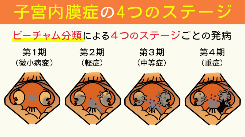 安らぎを見つける方法