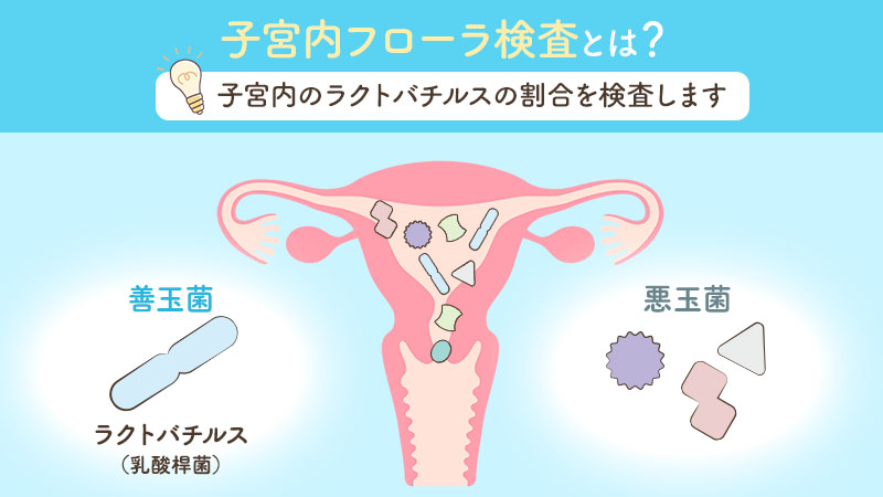 子宮内フローラ検査とは?子宮内のラクトバチルスの割合を検査します
