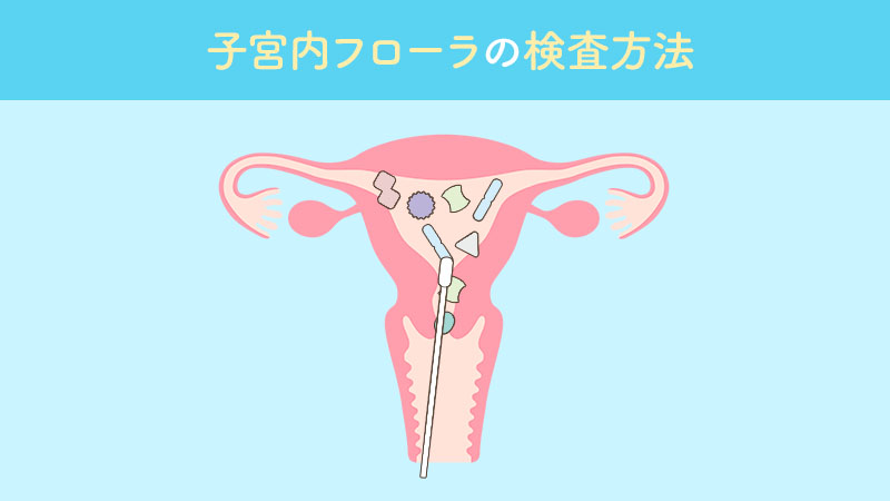 子宮内フローラの検査方法