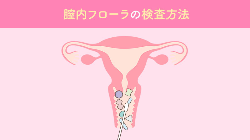 膣内フローラの検査方法